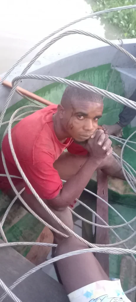 Cable Thief beaten

Image; Internet 